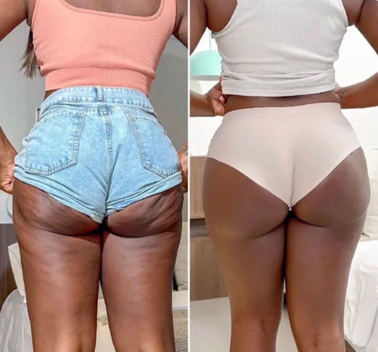 Appareil de Massage Minceur Électrique 3 en 1 (Vibro Masseur / Anti Cellulite / Brûleur de Graisse)