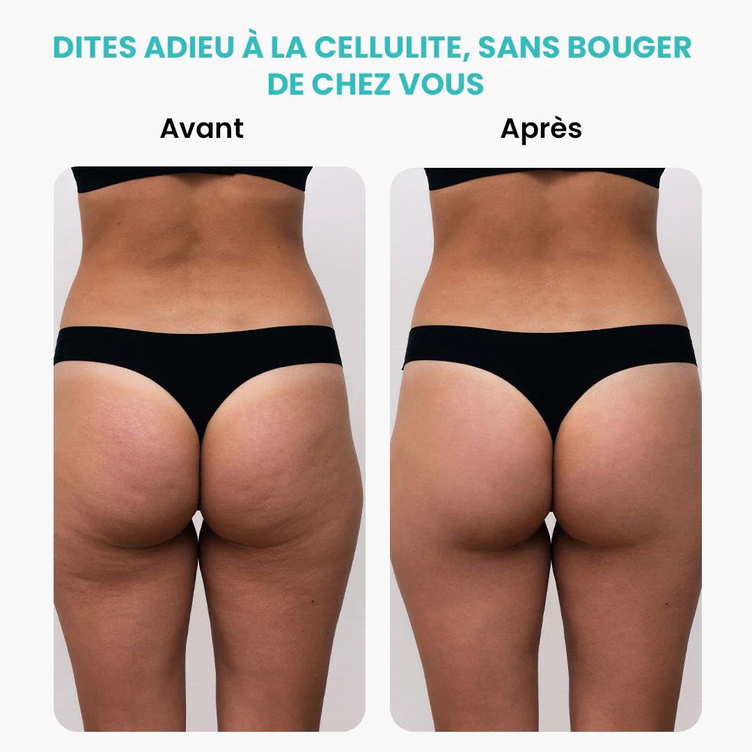 Appareil de Massage Minceur Électrique 3 en 1 (Vibro Masseur / Anti Cellulite / Brûleur de Graisse)