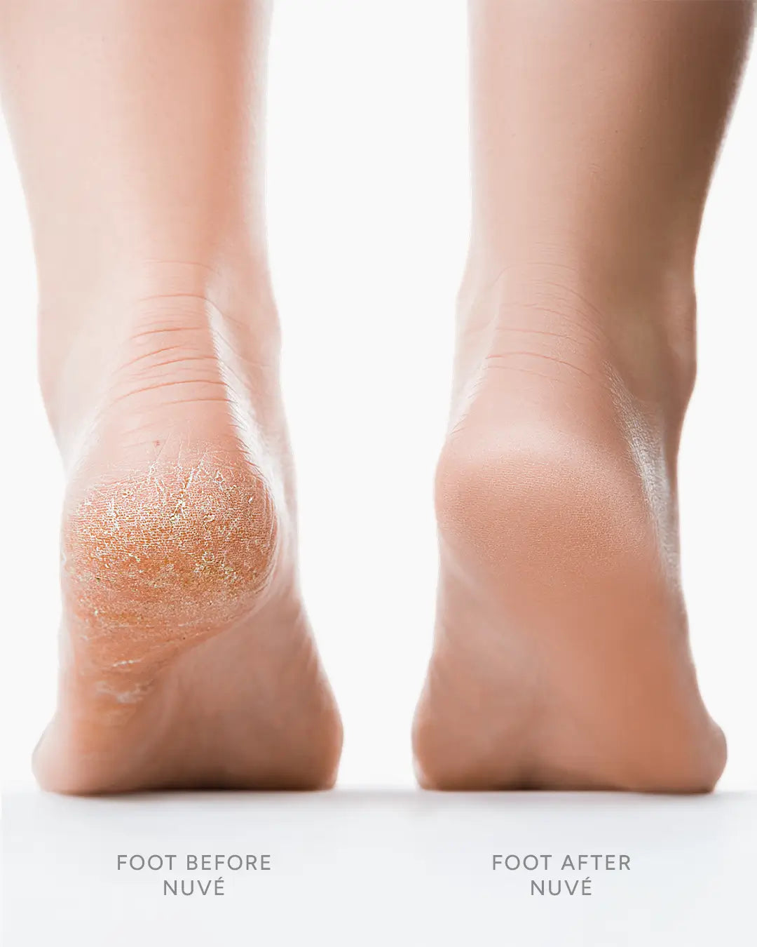 Lime électrique pour pieds